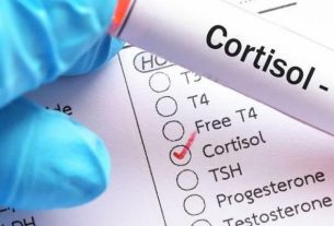Cortisol is a stress hormone: control of production and treatment of overestimated levels