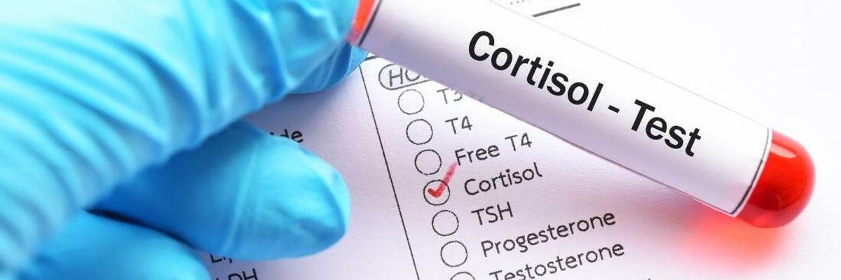 Cortisol is a stress hormone: control of production and treatment of overestimated levels